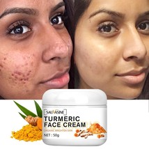 Turmeric Whitening Cream Dark Skin Acne Treatment Dark Spots Removal Brightening - £13.05 GBP