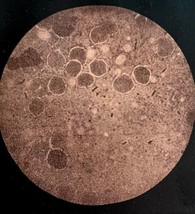 Hog Cholera Virus Swine Microscope Plate Print Victorian 1887 Agricultur... - £31.44 GBP