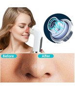 Blackhead Remover Pore Cleaner Vacuum Suction Acne Remover Pimple Black ... - $18.37+