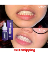 100% Unismile Linkare Colour Corector 10ml - Serum Trắng Răng Unismile - $515.59 MXN