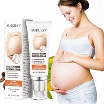 Maternity Scars Acne Cream Pregnancy Stretch Marks Remove Cream 7 Day Effect  - £6.82 GBP
