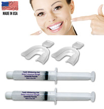 22% Teeth Whitening Bleach Kit - 2 Syringes + FREE 2 Thermoforming Mouth Trays - - $9.99