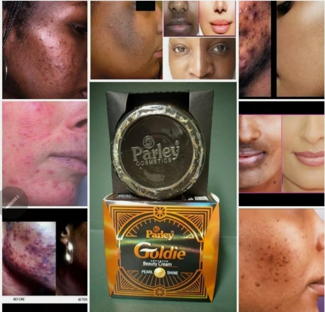 Goldie Parley Advance Beauty Cream