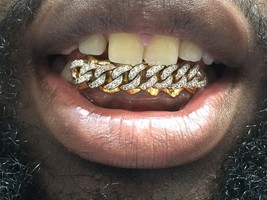 14k gold Overlay Removable gold teeth caps Grillz & mold kit 6 teeth /Cuban with - £233.77 GBP