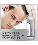 PRO-GROWTH MEN HAIR GROWTH CONDITIONER STOP HAIR LOSS THINNING &amp; BALDING - $46.28 CAD