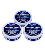 3 Pack Blue Goo Cracked Heel Skin Softner 2 oz-Multi Use Hands, Feet, Elbows-NEW - $37.51