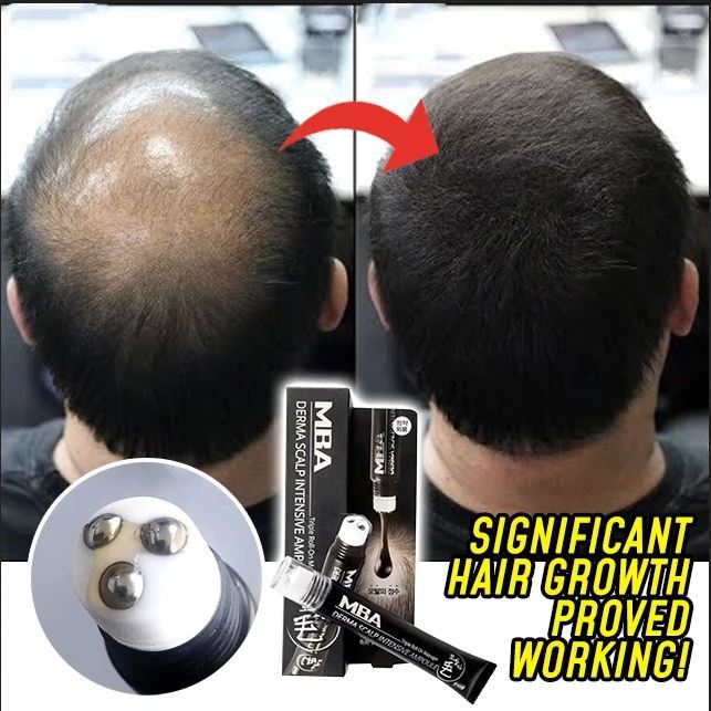 Bald Thining Scalp Intense Hair Growth Serum Triple Massager Fast Regrow... - $13.67