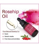 Natural Pure Essence Rosehip Oil Skin Care Remove Ance Treatment Anti-ag... - $22.49+