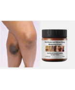 New Strong Whitening Cream For Removing Dark Knuckle Finger Elbow and Knee - $19.99