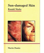 Sun-Damaged Skin Pocketbook Marks, Ronald Hardcover - $84.62