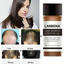 Unisex Lanbena Hair Loss Treatment Ginger Extract Hair Growth Essential Oil 20ml - £6.84 GBP