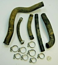 Radiator Coolant Hose Clamp Lot 1999 99 Suzuki RM125 RM 125 - £15.81 GBP