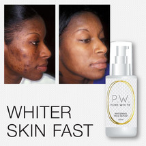 Pure White Whitening Face Serum Fairer Lighter Skin Fades Acne Scars Melasma - £44.40 GBP