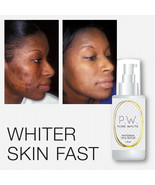 PURE WHITE WHITENING FACE SERUM FAIRER LIGHTER SKIN FADES ACNE SCARS MEL... - $1,065.26 MXN