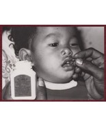 Child Nutrition Vitamin A Blindness Press Photo WPRO WHO - $18.49