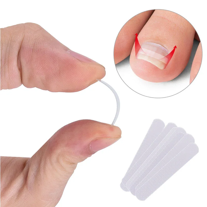 10pcs Ingrown Toenail Correction Tool Ingrown Toe Nail Treatment Elastic Patch - £6.70 GBP+