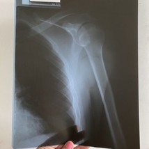 Real 2 X-Rays Shoulder Elbow Film Sheet for Education Art 11.5x9.2in PII... - $49.95