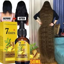 Ginger Essential Oil Promotes Fast Hair Growth and Treats Hair Loss in Men Women - $10.99