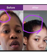 Trial Size Hair Growth oil - $2.00