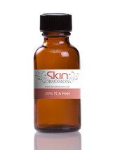 Skin Obsession 20% TCA Acid Peel - Treats Scars, Acne, Fine Lines, &amp; Dark Spots - £28.31 GBP