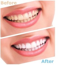 Advanced Teeth Whitening Strips (4 Strips) 2 Upper and 2 Lower~Hydrogen ... - $5.91