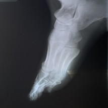 Real Foot X-Ray Side View Film Sheet for Education Art 11.5x9.2in PII Re... - £19.94 GBP