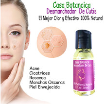 Desmanchador Casa Botanica 1oz Para Tu Cara O Piel 100% Realmente Skin Care Casa - £12.70 GBP