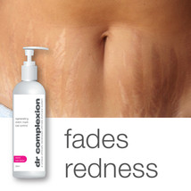 Dr Complexion Regenerating Stretch Mark Duel Control Lotion Fades Redness - £23.10 GBP