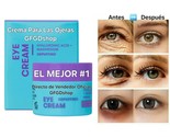 Crema Para Las Ojeras Anti-arrugas Remueve Bolsas En Los Ojos Y Circulos... - £15.15 GBP