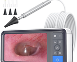 1920X1080 FHD Smart Visual Ear Cleaner with Camera Tool Kit, Plug &amp; Play... - $145.66