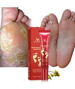 MeiYanQiong 15g Foot Repair Anti Crack Whitening Cream Foot Peeling Crac... - $15.60