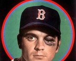 TONY CONIGLIARO 8X10 PHOTO BOSTON RED SOX BASEBALL PICTURE MLB - £4.63 GBP