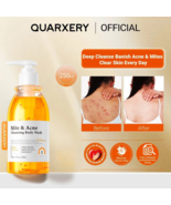 Quarxery Mite and Acne Body Wash 250ML New (Expiry 2027) - €33,04 EUR