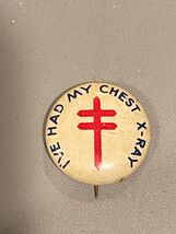 Vintage 3/4" I’ve Had My Chest X-Ray Button Pinback *Pre-Owned* DMA - $9.99