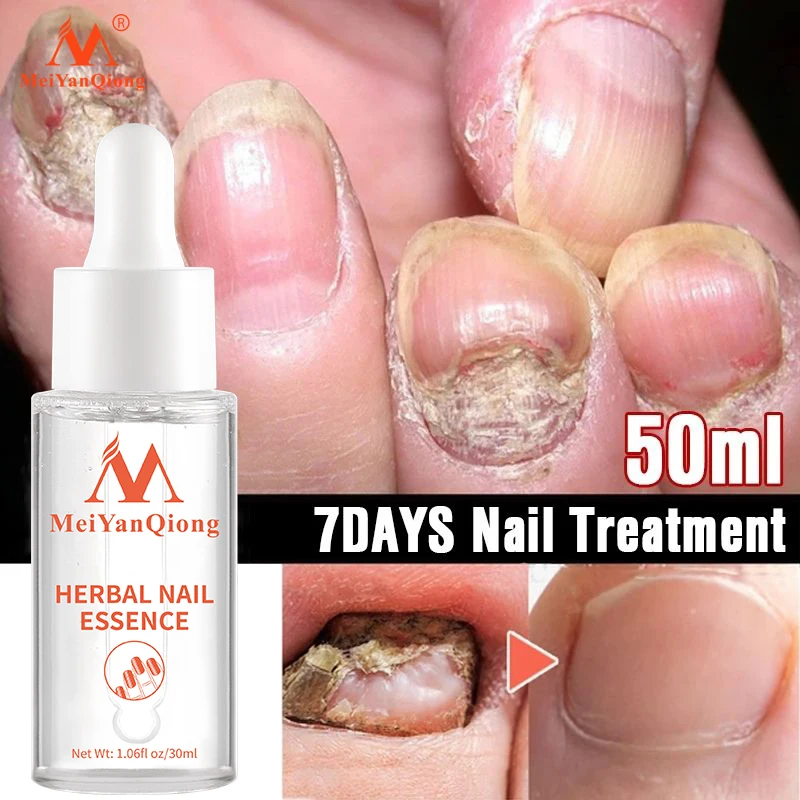 House Home Nail Treatment Essence Serum Care Hand and Foot Care Removal Repair I - £24.78 GBP