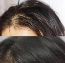 KIRAMEKI Hair lotions,Improves Hair Texture - $18.88