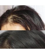 KIRAMEKI Hair lotions,Improves Hair Texture - $351.92 MXN