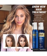 Hair Growth Essence Oil Spray For Hair Regrowth Anti Hair Loss DHT Men &amp;... - £15.73 GBP