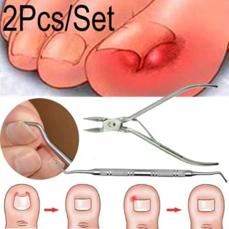 Ingrown Toenails Pedicure Foot Care Tool Nail Correction Clipper Cutters For - £9.00 GBP