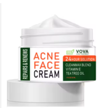 Acne Cream for Pimples Acne Spots Blackhead 30g - £7.97 GBP