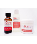 Skin Obsession 15% TCA Peel Kit - $41.99