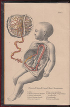 1891 Russian Medicine Pediatrics Textbook Child Diseas Vogel Biedert Russia - £277.72 GBP