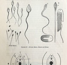 Human Sperm Seminal Fluid And Hymen 1878 Victorian Medical Anatomy Print DWV6C - £23.91 GBP