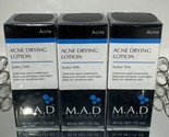 Bundle of 3 M.A.D SKINCARE Acne Drying Lotion ~Sulfur 10%~EXP 07/25 ~ Se... - $47.51