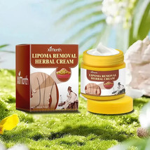 Lipoma Removal All Natural Herbal Cream - £23.41 GBP