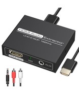 4K HDMI Audio Extractor with 3.5mm AUX and RCA Output for Gaming - $60.42 CAD