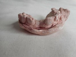 Vintage Cast Dental Teeth Mold  Tooth Castings Medical Oddity #10 - $702.36 MXN