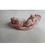 Vintage Cast Dental Teeth Mold  Tooth Castings Medical Oddity #10 - $700.09 MXN