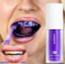 Smilekit V34 Toothpaste Whitening teeth - $24.99