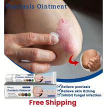 Psoriasis Dermatitis Eczema Natural Cream Skin Treatment Ointment FREE S... - $16.73